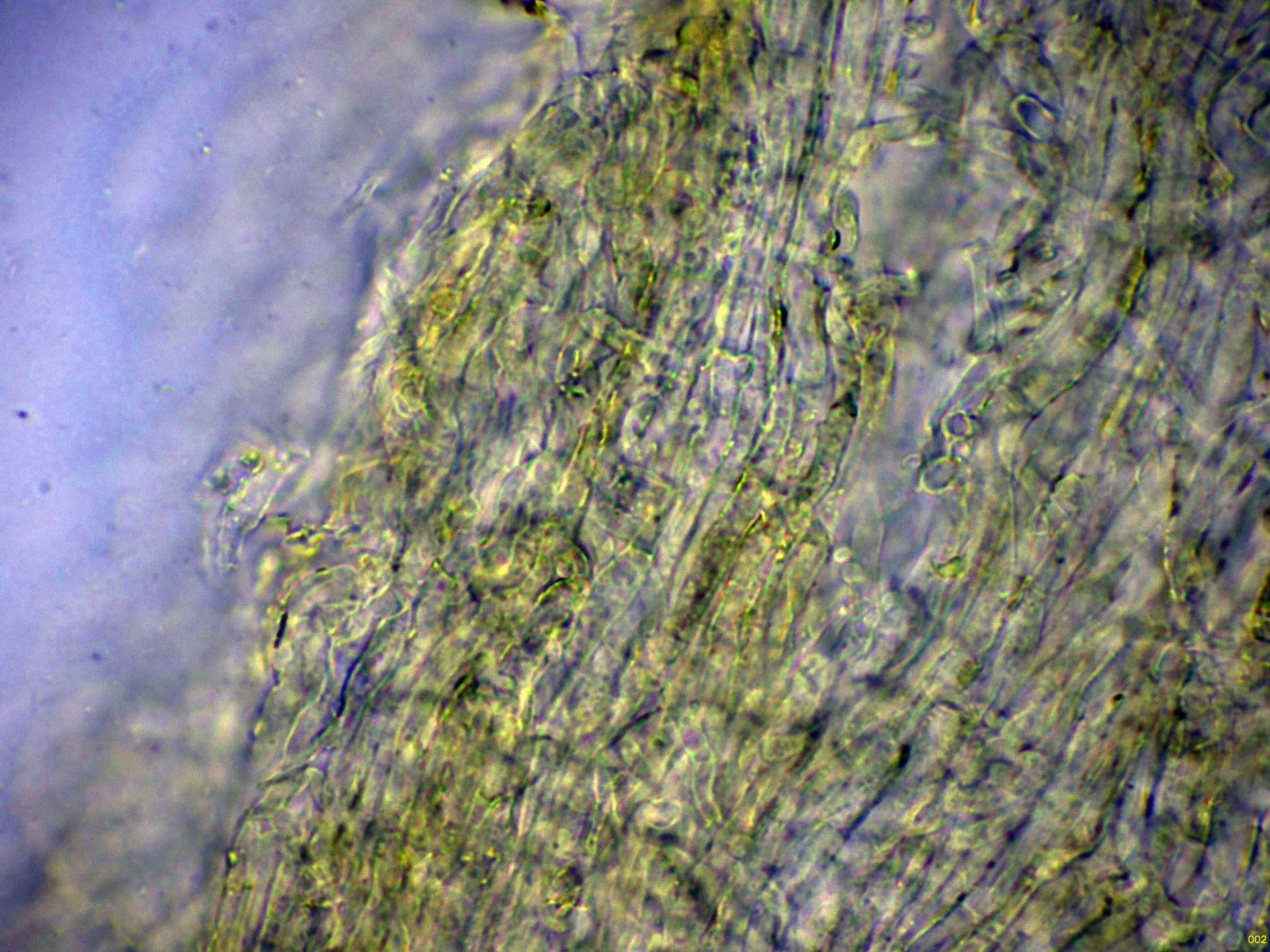 Microscopía de Tolypocladium ophioglossoides - 9 - Contexto agua-002